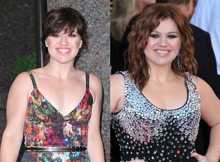 Amazing Powers of Science: Kelly Clarkson Before and After Plastic ...